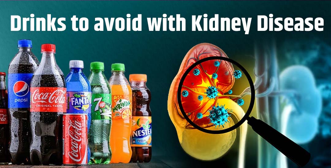 Which Drinks Should Be Avoided in Kidney Disease?